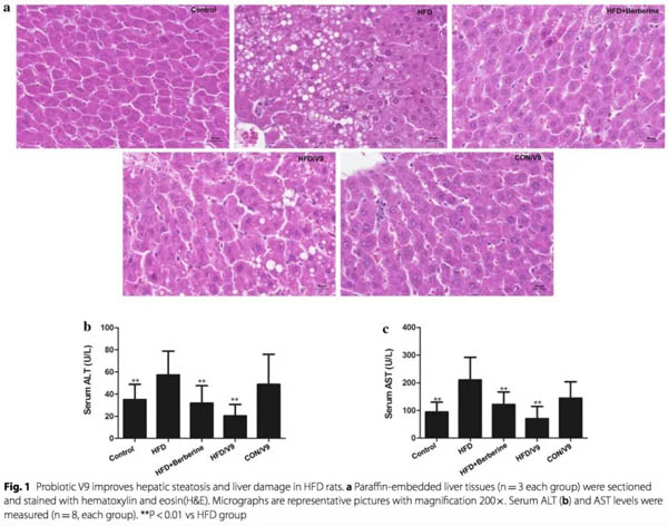 乳双歧杆菌V9减轻大鼠肝脂肪变性和氨基化